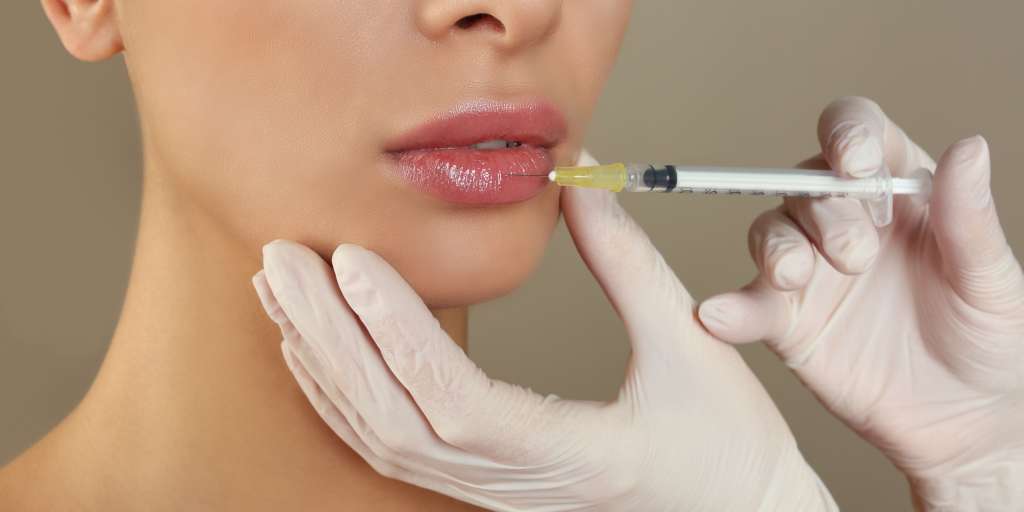 how-long-does-filler-last-in-lips-dr-yousefi