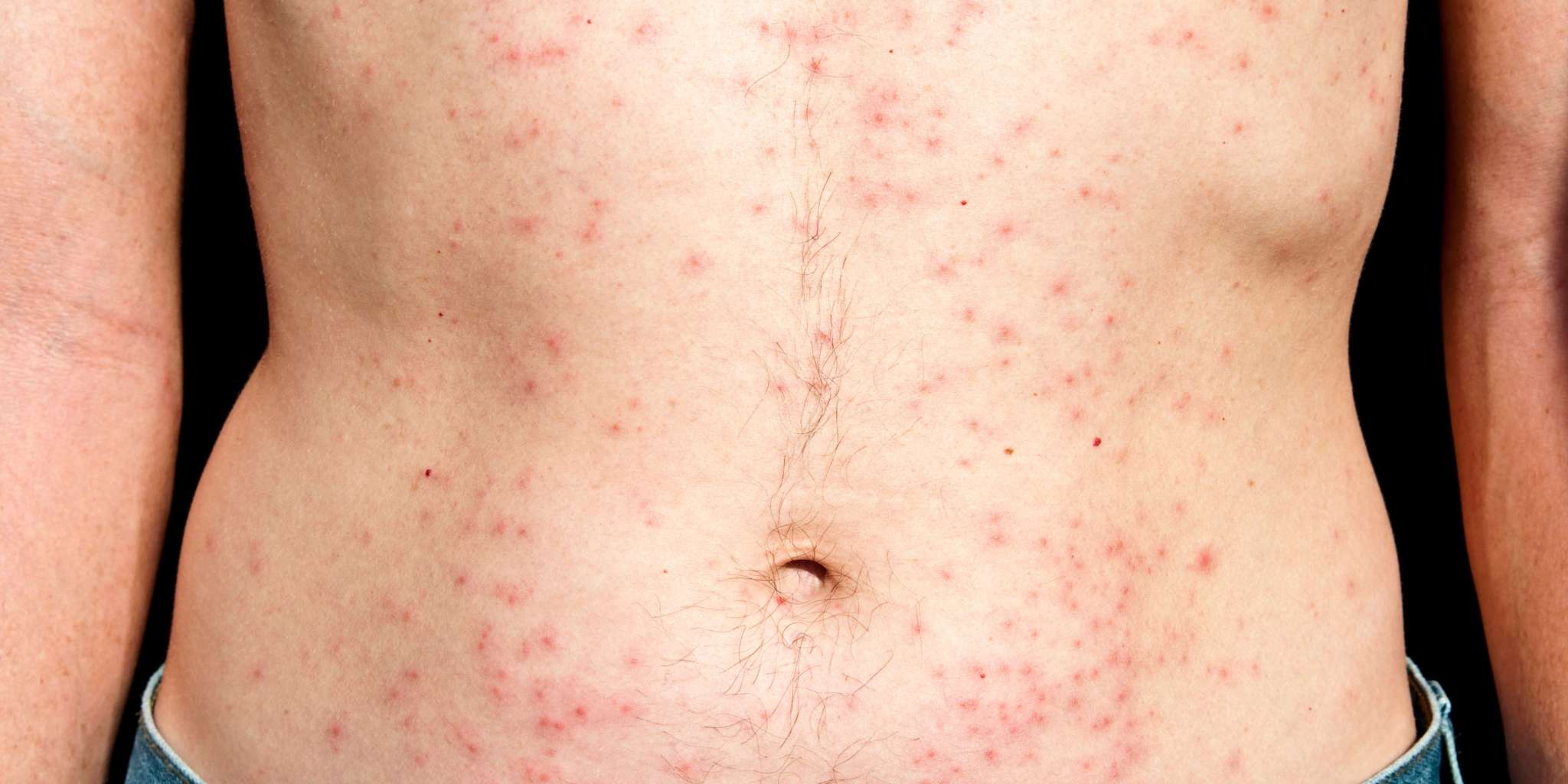 red-dots-on-skin-dr-yousefi