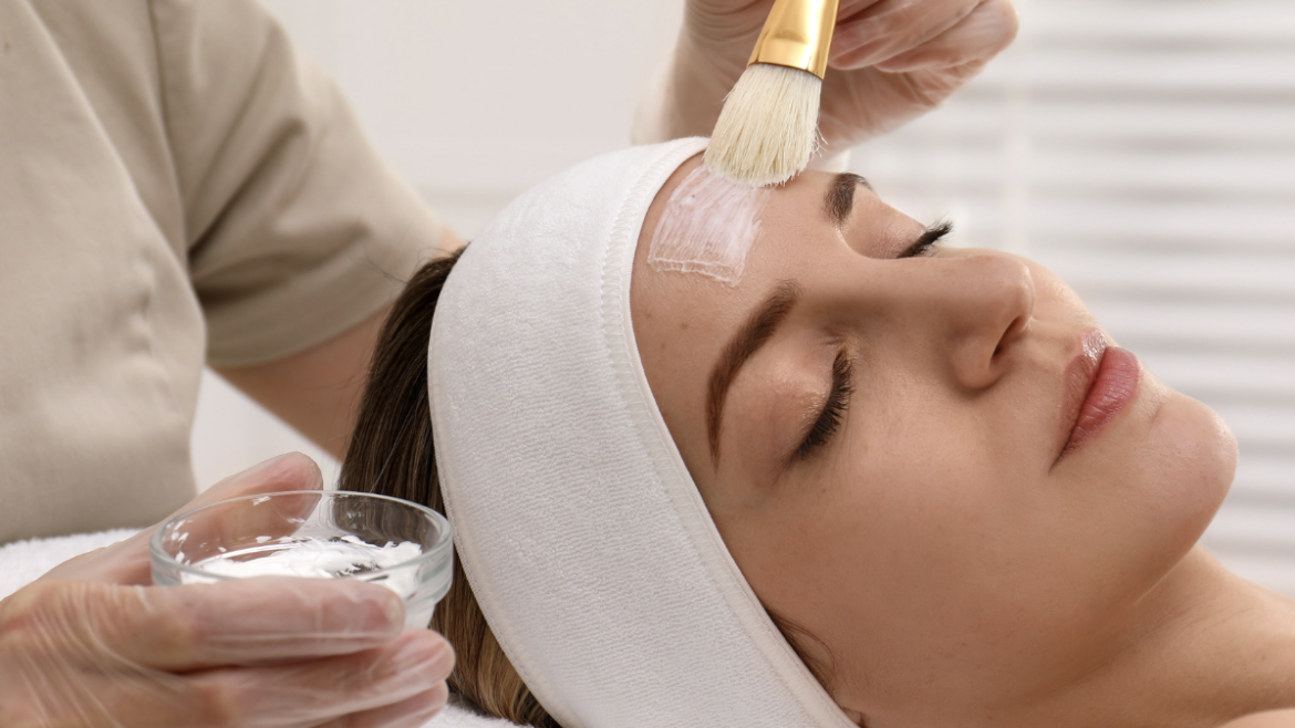 Chemical Peels for Acne Near Arlington