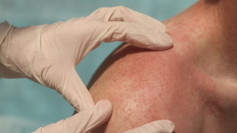 Same-Day Emergency Rash Appointment Near Falls Church