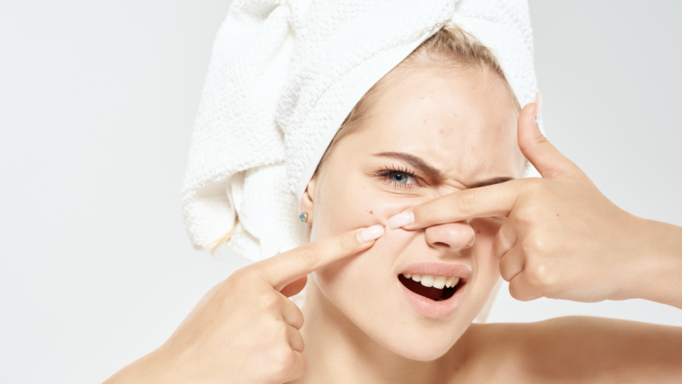 Advanced Acne Treatments in Vienna & Falls Church