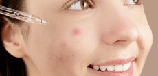 Same-Day Acne Appointment With a Top-Rated Dermatologist in McLean