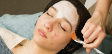 Quick Acne Treatment Options in Loudon County