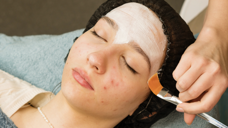 Quick Acne Treatment Options in Loudon County