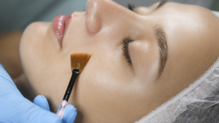 Revitalize Your Skin With Expert Chemical Peel Treatments in Reston