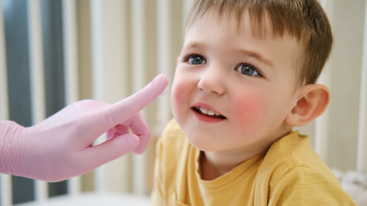 Pediatric Dermatology Near Chantilly