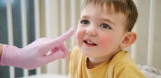 Pediatric Dermatology Near Chantilly